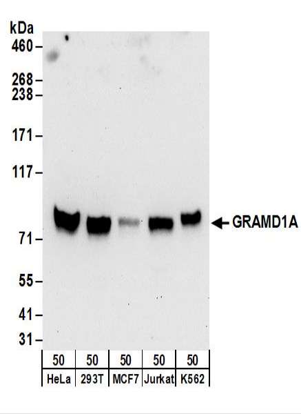 Detection of Human GRAMD1A by Western Blot. Samples: Whole cell lysate (50 ug) from HeLa, 293T, MCF7, Jurkat, and K562 cells. Antibodies: Affinity purified rabbit anti-GRAMD1A antibody used for WB at 0.4 ug/ml. Detection: Chemiluminescence with an exposure time of 30 seconds.