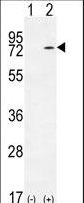 Western blot of KARS (arrow) using rabbit polyclonal KARS Antibody. 293 cell lysates (2 ug/lane) either nontransfected (Lane 1) or transiently transfected (Lane 2) with the KARS gene.