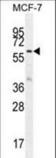 KARS Antibody western blot of MCF-7 cell line lysates (35 ug/lane). The KARS antibody detected the KARS protein (arrow).