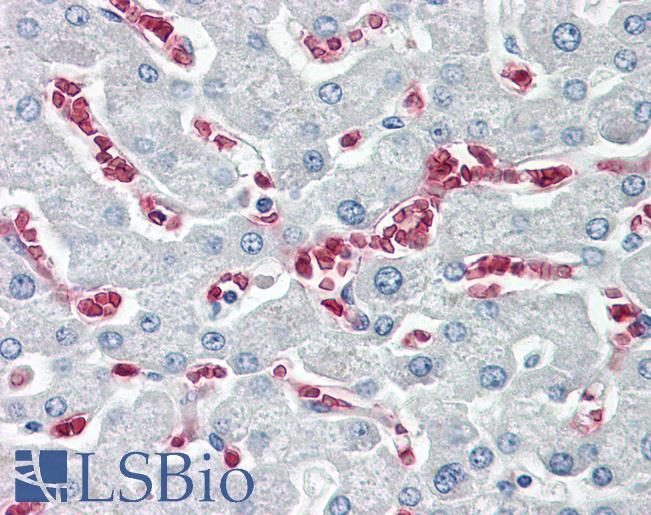 Anti-KARS antibody IHC of human liver. Immunohistochemistry of formalin-fixed, paraffin-embedded tissue after heat-induced antigen retrieval. Antibody LS-B8077 dilution 5-10 ug/ml.