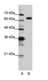 A: Marker, B: HepG2 Cell Lysate