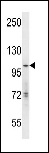 hGCN5 Antibody western blot of mouse Neuro-2a cell line lysates (35 ug/lane). The hGCN5 antibody detected the hGCN5 protein (arrow).
