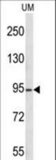 KAT2A Antibody western blot of uterus tumor cell line lysates (35 ug/lane). The KAT2A antibody detected the KAT2A protein (arrow).
