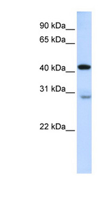 GRAMD2 antibody LS-C102123 Western blot of Fetal Lung lysate.