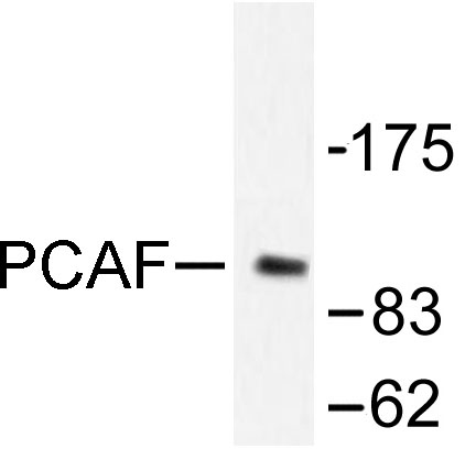 Western blot of PCAF (F820) pAb in extracts from COLO205 cells.