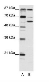 A: Marker, B: HepG2 Cell Lysate