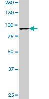 PCAF monoclonal antibody (M13), clone 1E3. Western blot of PCAF expression in MES-SA/Dx5.