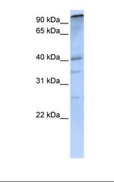 MCF7 cell lysate. Antibody concentration: 1.0 ug/ml. Gel concentration: 12%.