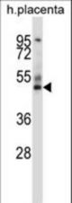 GRAMD3 Antibody (N-term ) western blot of human placenta tissue lysates (35 ug/lane). The GRAMD3 antibody detected the GRAMD3 protein (arrow).