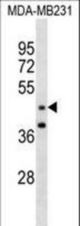 GRAMD3 Antibody (N-term )western blot of MDA-MB231 cell line lysates (35 ug/lane). The GRAMD3 antibody detected the GRAMD3 protein (arrow).