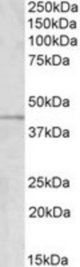 GRAMD3 antibody (1 ug/ml) staining of Human Temporal Cortex lysate (35 ug protein/ml in RIPA buffer). Primary incubation was 1 hour. Detected by chemiluminescence.