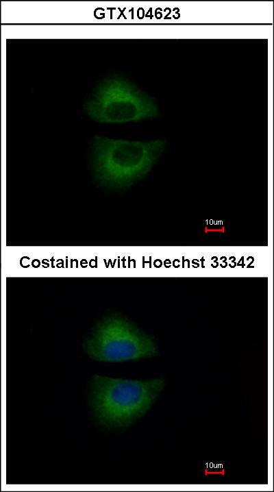Immunofluorescence of methanol-fixed A549 using GRAP antibody at 1:500 dilution.