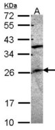 Sample (30 ug of whole cell lysate). A: A549 12% SDS PAGE. GRAP antibody diluted at 1:1000.