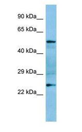 GRAP antibody Western Blot of Rat Spleen.
