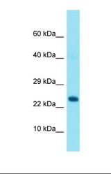 Western blot of Human Fetal Brain. GRAP antibody dilution 1.0 ug/ml.