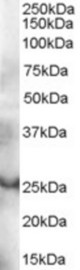 Antibody (0.3 ug/ml) staining of human thymus lysate (35 ug protein in RIPA buffer). Primary incubation was 1 hour. Detected by chemiluminescence.