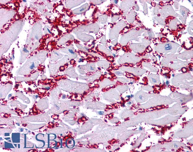 Anti-KCNA10 / Kv1.8 antibody IHC of human heart. Immunohistochemistry of formalin-fixed, paraffin-embedded tissue after heat-induced antigen retrieval. Antibody LS-B4576 concentration 5 ug/ml.