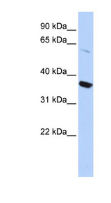 KCNA10 / Kv1.8 antibody LS-B4576 Western blot of HepG2 cell lysate.