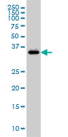 GRAP2 monoclonal antibody (M01), clone 1G12 Western blot of GRAP2 expression in Jurkat.