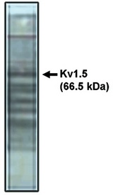 Western blot of Kv1.5 antibody on rat brain lysate.