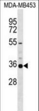 KCNA5 Antibody western blot of MDA-MB453 cell line lysates (35 ug/lane). The KCNA5 antibody detected the KCNA5 protein (arrow).