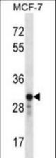 GRAP2 Antibody western blot of MCF-7 cell line lysates (35 ug/lane). The GRAP2 antibody detected the GRAP2 protein (arrow).