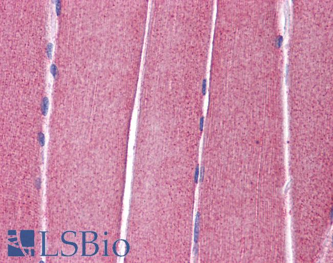 Anti-KCNC4 / Kv3.4 antibody IHC of human skeletal muscle. Immunohistochemistry of formalin-fixed, paraffin-embedded tissue after heat-induced antigen retrieval. Antibody LS-B5615 concentration 5 ug/ml.