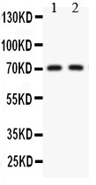 Kv4.2 antibody Western blot. All lanes: Anti Kv4.2 at 0.5 ug/ml. Lane 1: Rat Brain Tissue Lysate at 50 ug. Lane 2: Mouse Brain Tissue Lysate at 50 ug. Predicted band size: 71 kD. Observed band size: 71 kD.