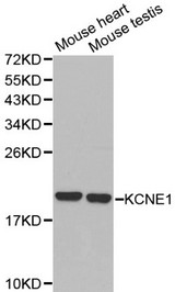 Western blot of KCNE1 pAb in extracts from mouse heart and testis tissues.