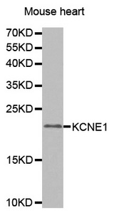 Western blot analysis of extracts of mouse heart tissue lines, using KCNE1 antibody.