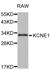 Western blot analysis of extracts of RAW cell line, using KCNE1 antibody.