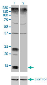 Western blot analysis of KCNE1 over-expressed 293 cell line, cotransfected with KCNE1 Validated Chimera RNAi (Lane 2) or non-transfected control (Lane 1). Blot probed with KCNE1 monoclonal antibody (M01), clone 5B12 . GAPDH ( 36.1 kDa ) used as specificity and loading control.