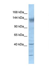 KCNH2 / Kv11.1 antibody LS-C145542 Western blot of Mouse Kidney lysate. Antibody concentration 1 ug/ml.