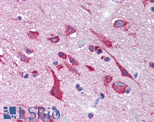 Anti-KCNH2 / Kv11.1 antibody LS-A9561 IHC of human brain, cortex. Immunohistochemistry of formalin-fixed, paraffin-embedded tissue after heat-induced antigen retrieval.
