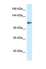 KCNH3 / Kv12.2 antibody LS-C145544 Western blot of COL0205 Cell lysate. Antibody concentration 1 ug/ml.