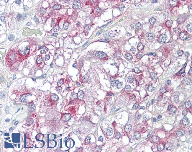 Anti-KCNH3 antibody IHC of human adrenal. Immunohistochemistry of formalin-fixed, paraffin-embedded tissue after heat-induced antigen retrieval. Antibody LS-B8071 dilution 5-10 ug/ml.