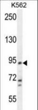 KCNH4 Antibody western blot of K562 cell line lysates (35 ug/lane). The KCNH4 antibody detected the KCNH4 protein (arrow).