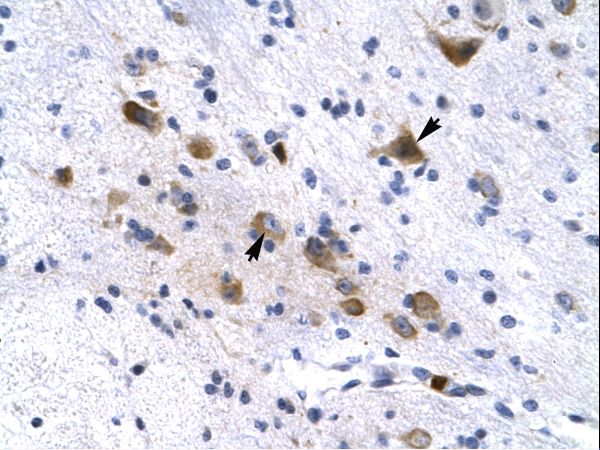 KCNH6 / Kv11.2 antibody LS-C31465 was used in IHC to stain formalin-fixed, paraffin-embedded human brain.