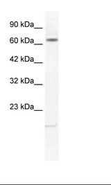 Jurkat Cell Lysate