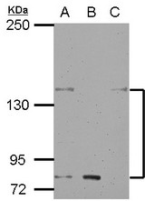 Sample (30 ug of whole cell lysate) A: H1299 B: HCT116 C: MCF-7 5% SDS PAGE KCNH7 / Kv11.3 antibody diluted at 1:500