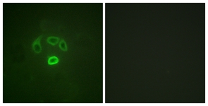 Immunofluorescence of HepG2 cells, using GRB10 (Phospho-Tyr67) Antibody. The sample on the right was incubated with synthetic peptide.