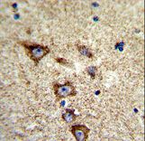 Formalin-fixed and paraffin-embedded human brain tissue reacted with KCNH7 Antibody , which was peroxidase-conjugated to the secondary antibody, followed by DAB staining. This data demonstrates the use of this antibody for immunohistochemistry; clinical relevance has not been evaluated.