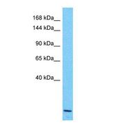 Western blot of Human Stomach Tumor. KCNH8 antibody dilution 1.0 ug/ml.
