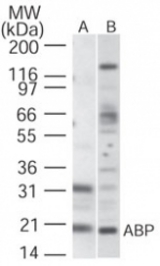 Western blot of ABP in (A) human brain and (B)human heart cell lysate using antibody at1 ug/ml.
