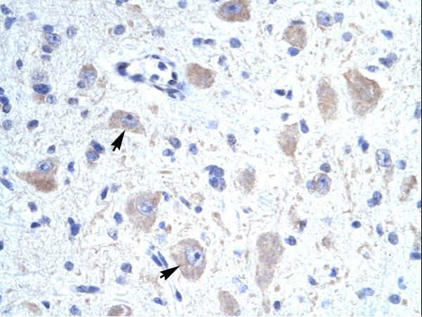 KCNIP1 antibody LS-C30612 was used in IHC to stain formalin-fixed, paraffin-embedded human brain.