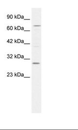 Jurkat Cell Lysate