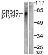 Western blot of extracts from NIH-3T3 cells treated with Insulin 0.01U/ml 15', using GRB10 (Phospho-Tyr67) Antibody. The lane on the right was incubated with synthetic peptide.