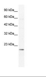 Jurkat Cell Lysate