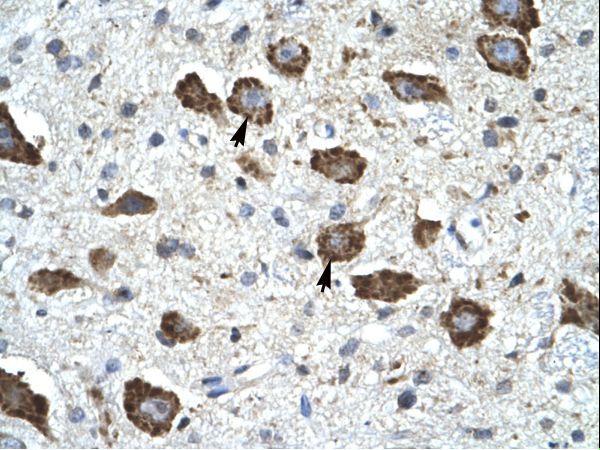 KCNIP2 / KCHIP2 antibody LS-C19241 was used in IHC to stain formalin-fixed, paraffin-embedded human brain.