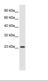 Jurkat Cell Lysate